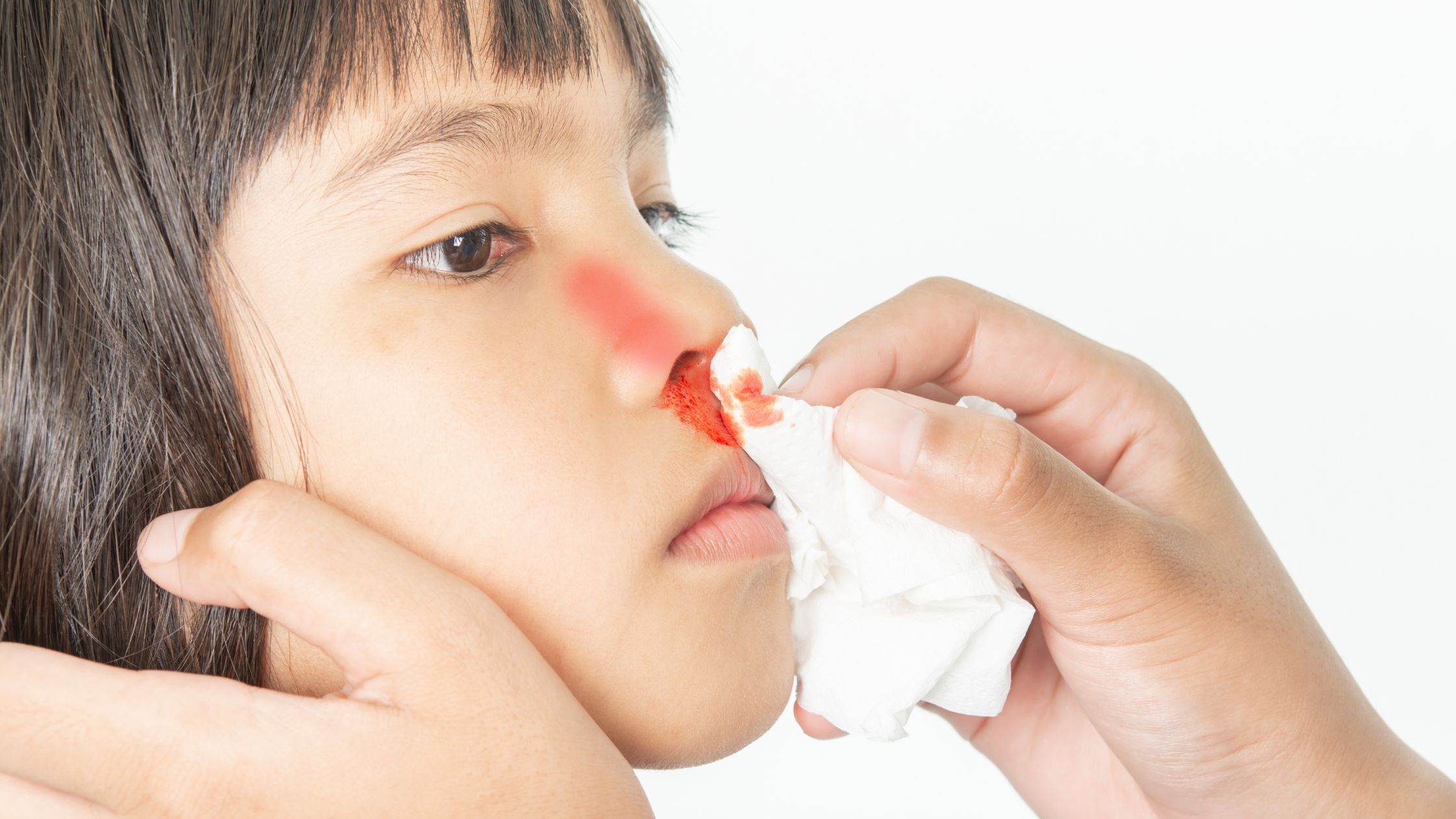 nosebleeds-in-children-when-to-see-a-doctor-causes-and-prevention